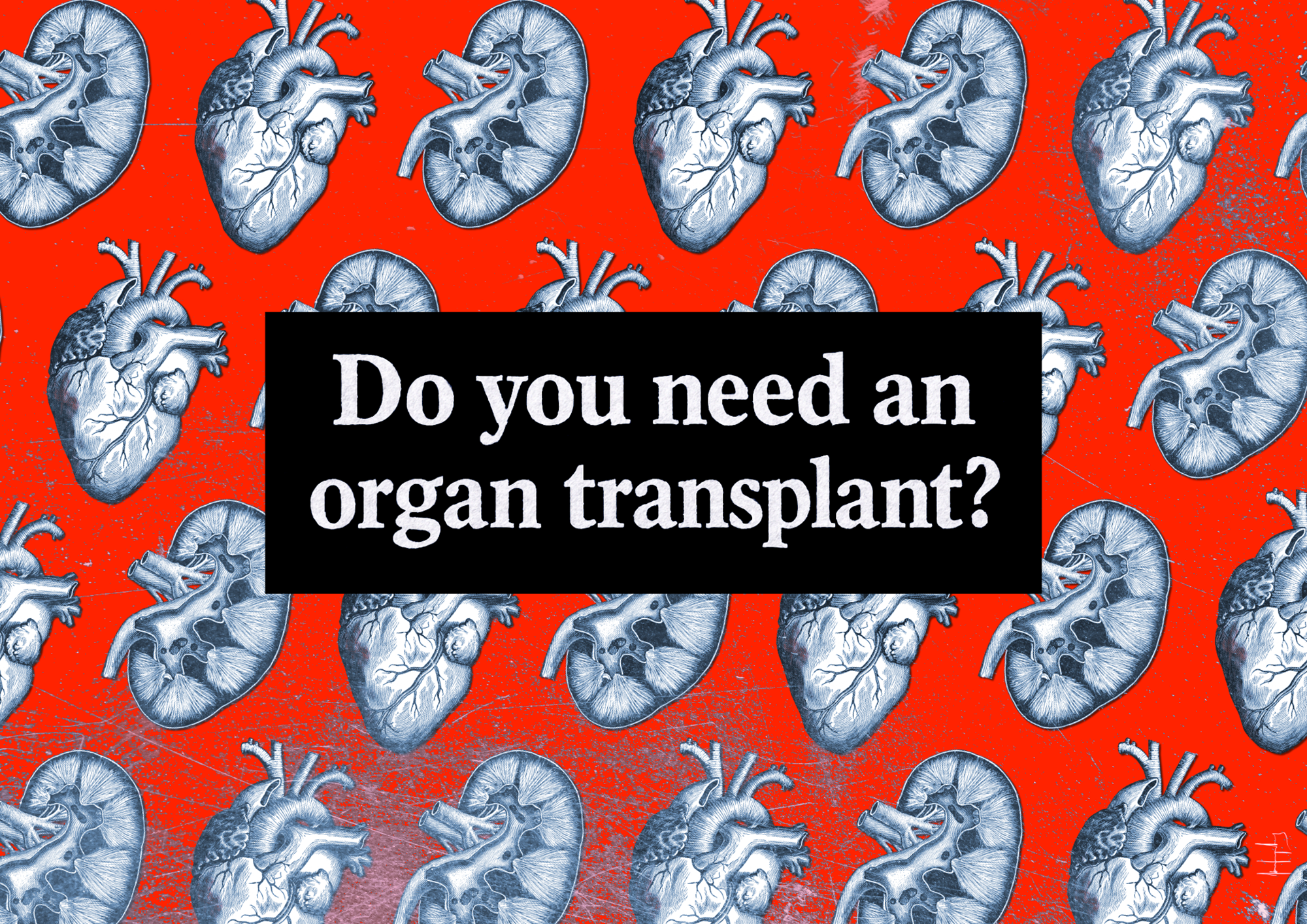 Illustrated pattern of human hearts and kidneys on a red background with a black rectangular box in the center containing the white text “Do you need an organ transplant?”